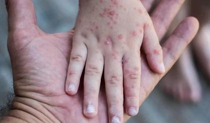 Alarm! Son 25 yılın en yüksek seviyesine ulaştı!