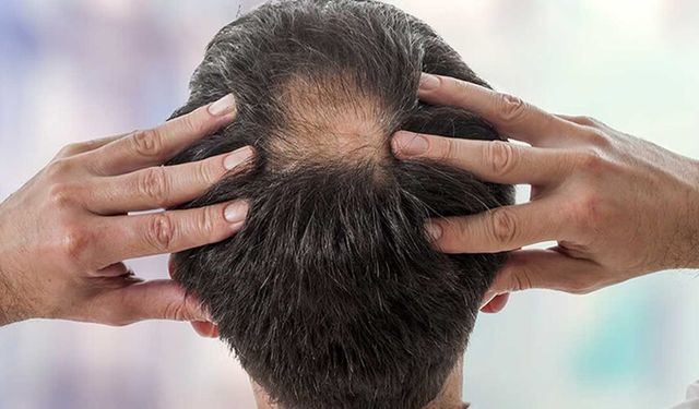 Her gün saç yıkamak zararlı mı?