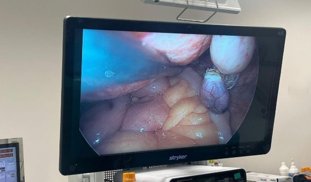 Erzincan’da “V-NOTES Cerrahisi” Başarıyla Uygulandı