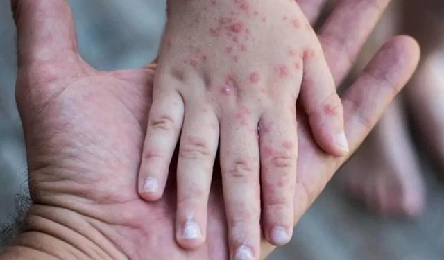 Alarm! Son 25 yılın en yüksek seviyesine ulaştı!