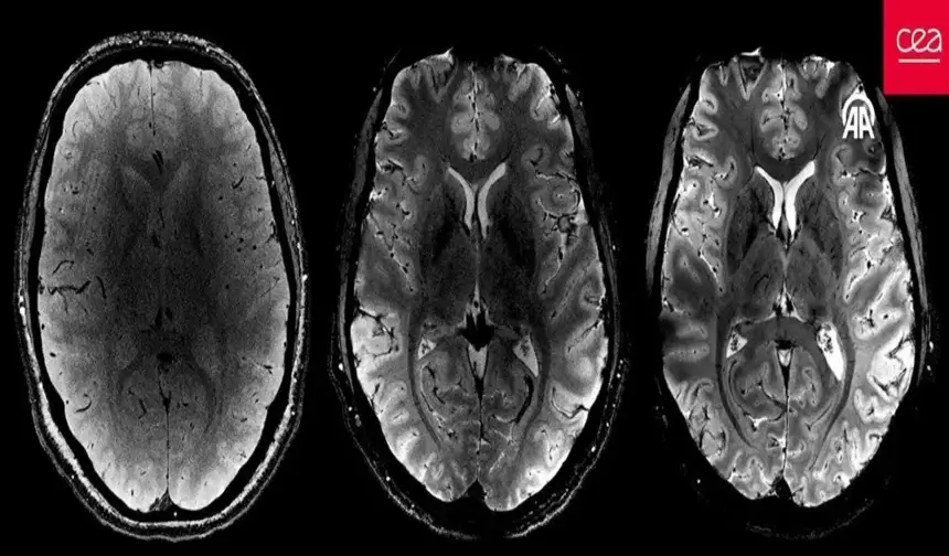 20 yıllık bir çalışma! İnsan beyninin en net görüntüsü yayınlandı!